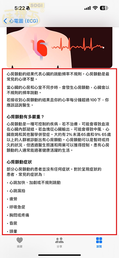 如何測量心電圖？ - 心房顫動