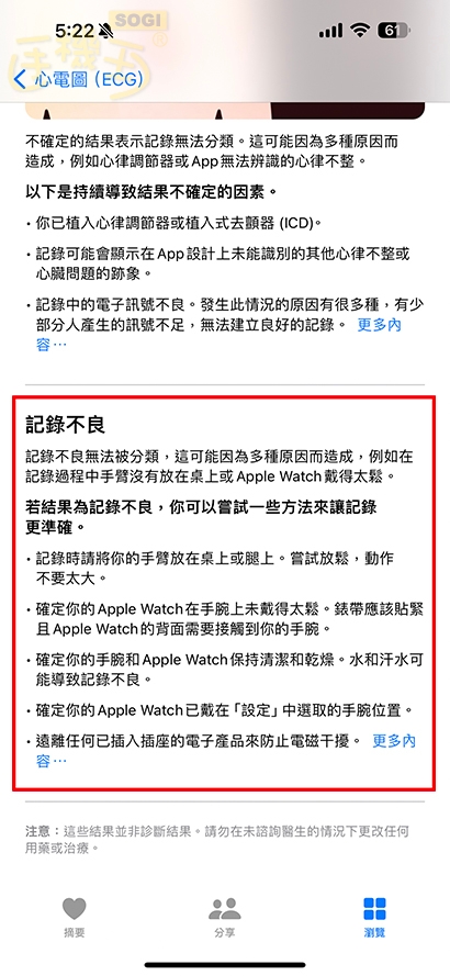 如何測量心電圖？ - 記錄不良